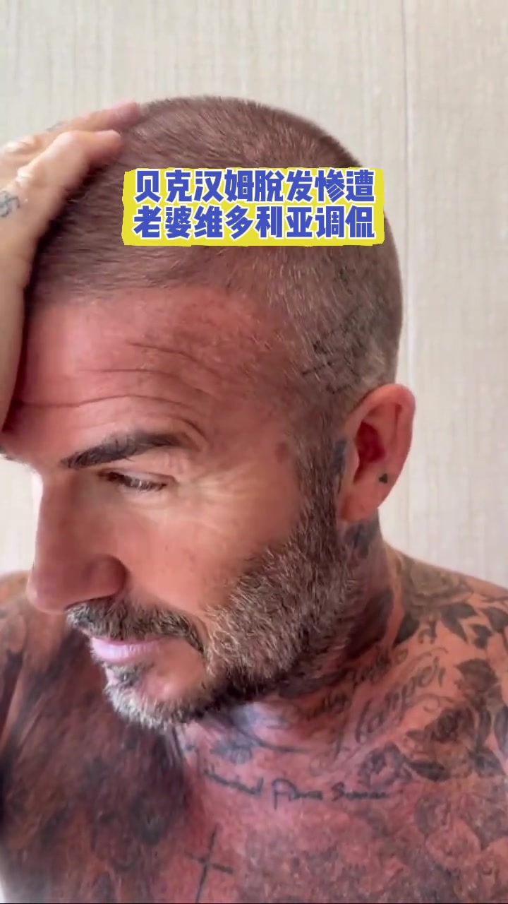 小貝也有中年危機(jī)貝克漢姆脫發(fā)慘遭老婆維多利亞調(diào)侃